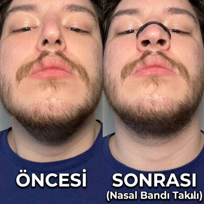 Airly - Mıknatıslı Nasal Bant