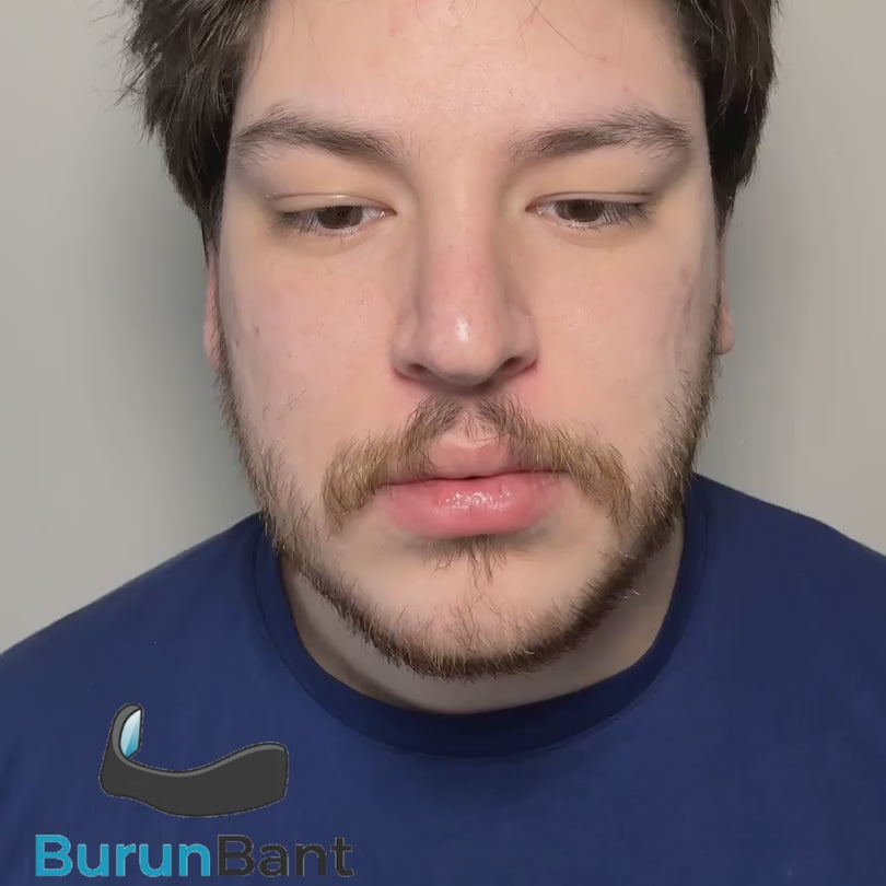 Airly - Mıknatıslı Nasal Bant